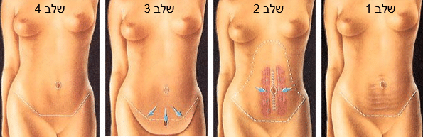 שלבים למתיחת בטן